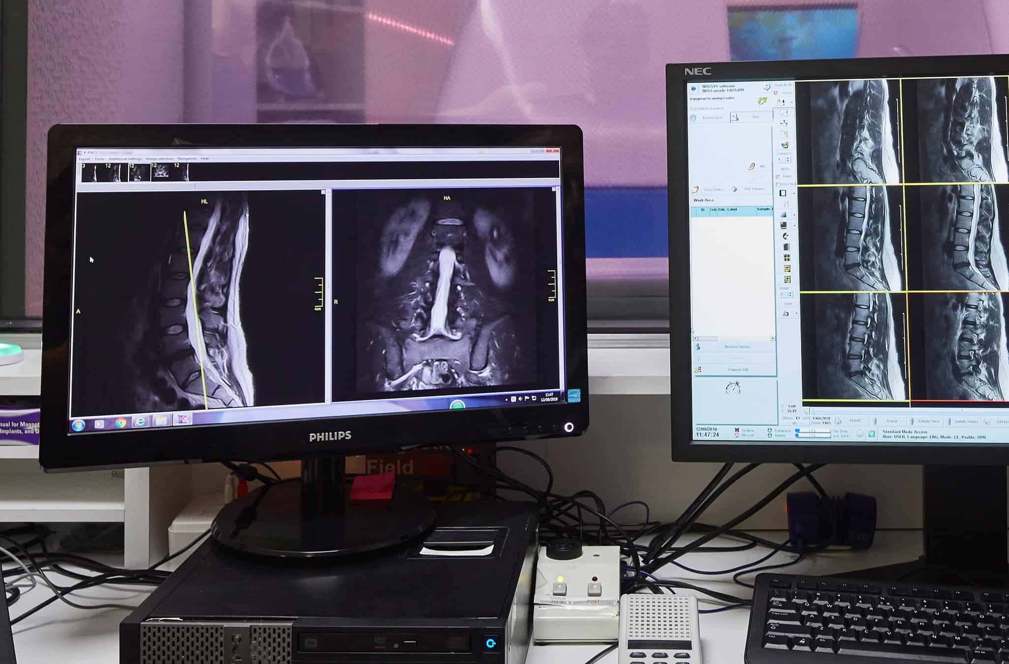 Viewing Images on the control monitor of an MRI Scanner