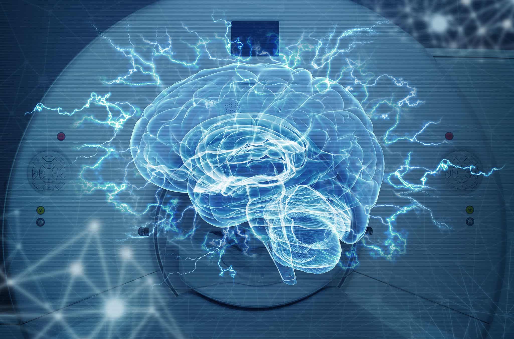 Echelon Health - dramatic picture of the brain